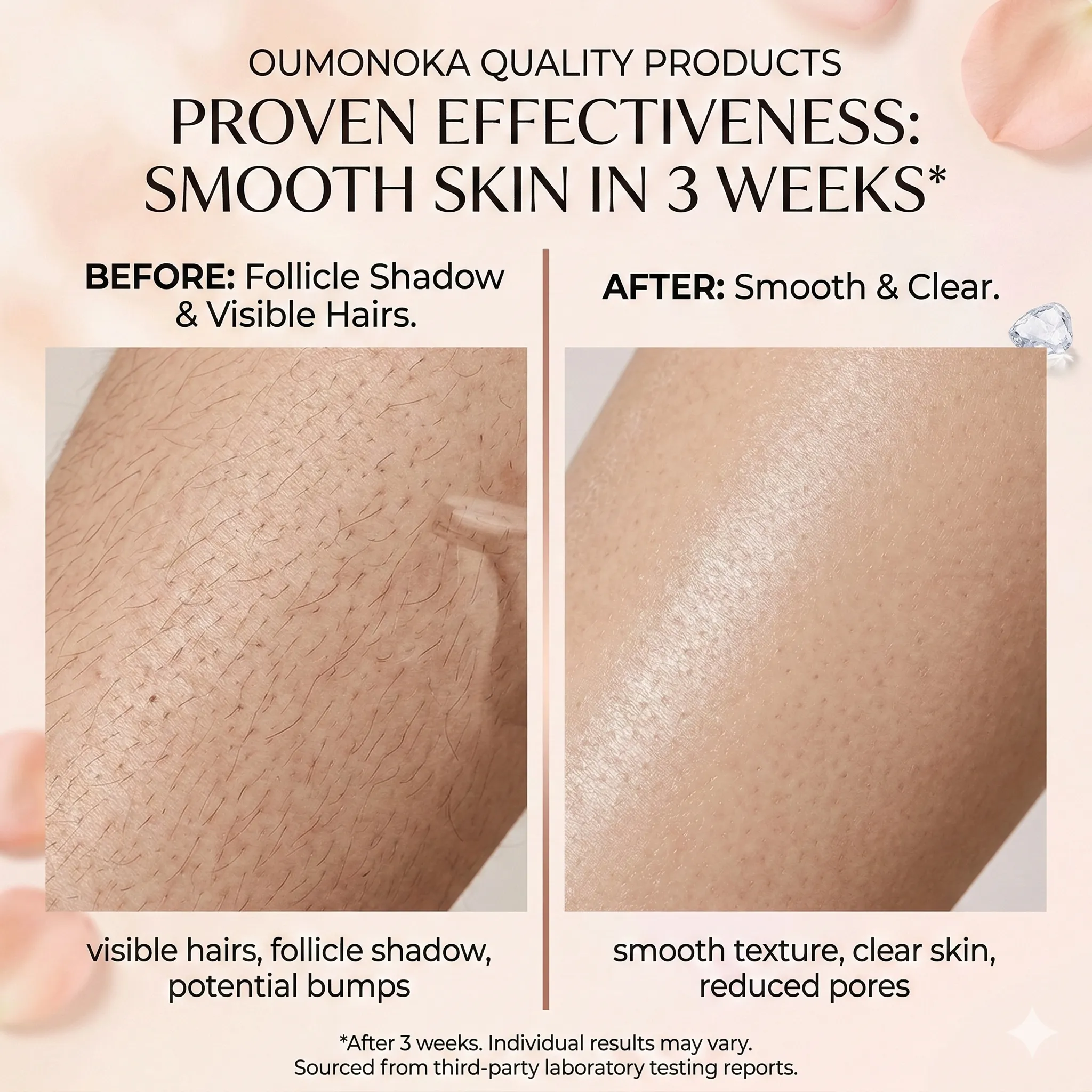 Avant et après utilisation IPL